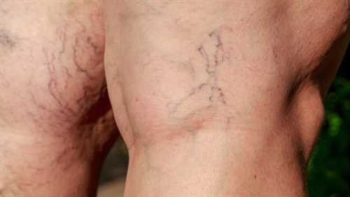 如何才能瘦腿?瘦腿方法背后的几大传闻